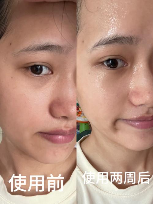 Skin Diary-������¼С���� ÿ�����ռ�¼ ���ʱ仯�Աȹ���