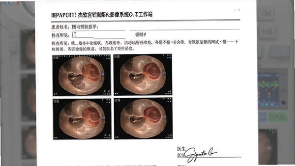 ������ǻ��Ӱ��ϵͳ����վ��ͼ�ı����ӡԤ�����棬���浥�ϰ���������������������������������Ź�ǻ��ͼ������ͼ�Լ�ҽ��ǩ�����򣬱����Ű������淶